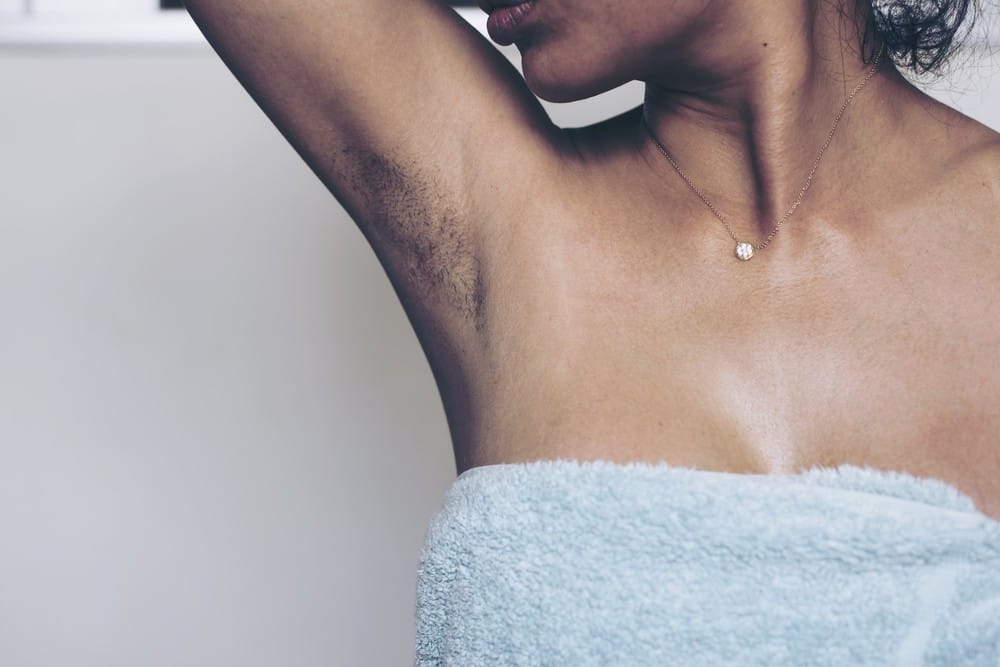 A woman raising her arm to reveal visible armpit stubble in need of unwanted hair removal