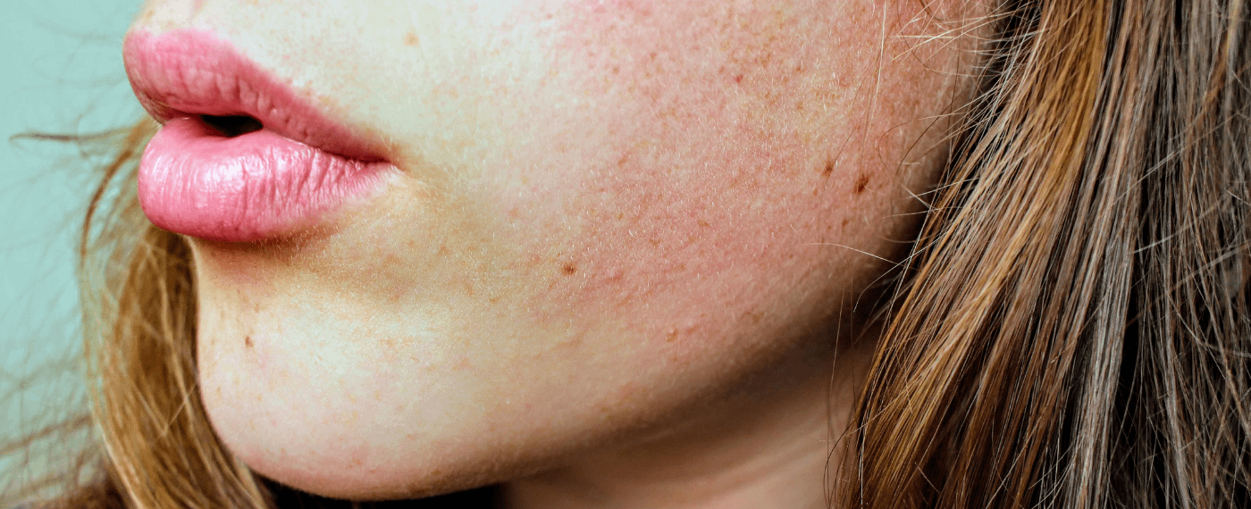 A woman pondering if her irritated skin is a sign of an issue within