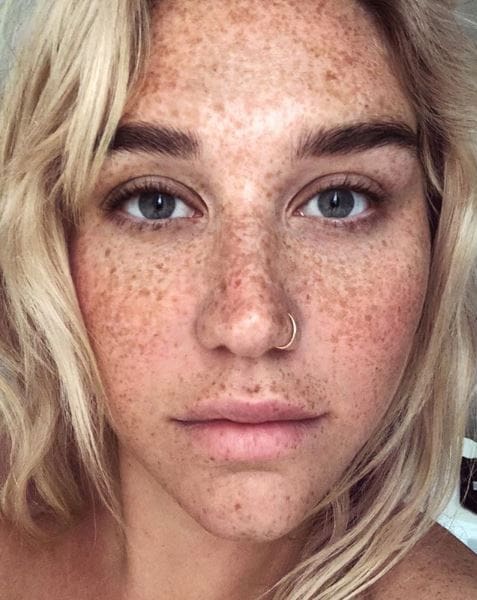 Recording artist Kesha shares her makeup-free freckles