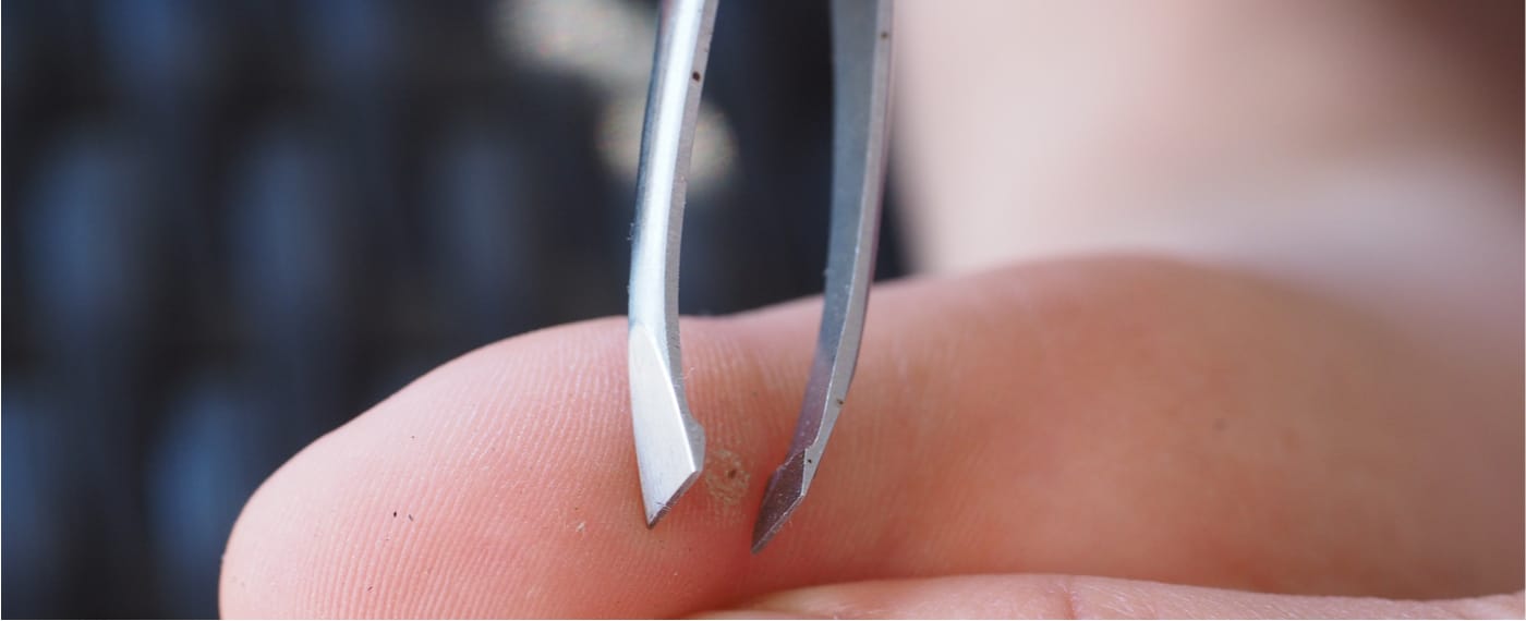 Tweezers being used to pull a splinter from the skin of a finger after using epsom salt