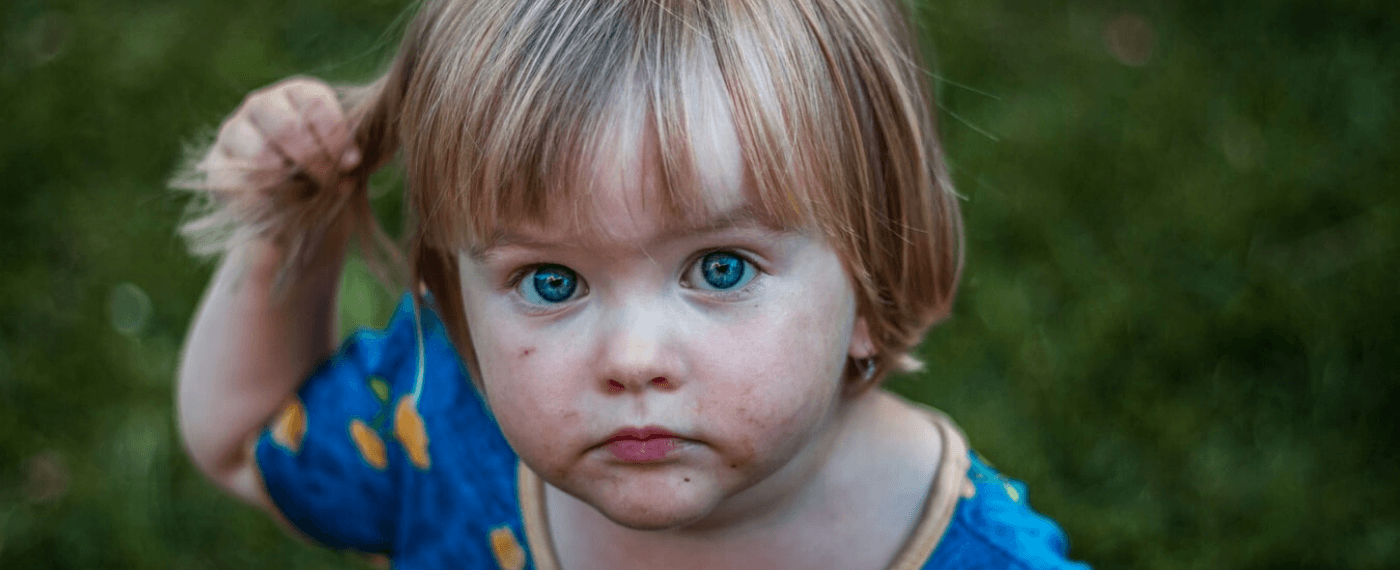 female toddler with food allergies looking up at camera with smudges on her cheeks