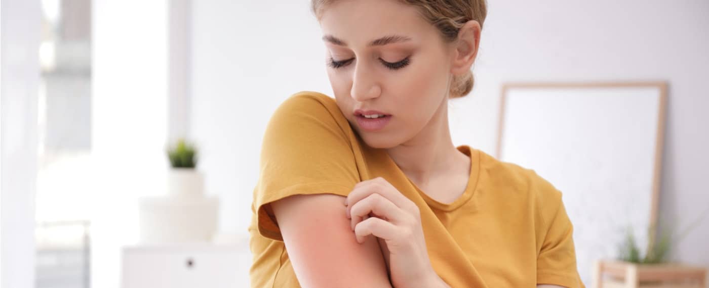woman scratching at eczema on her arm