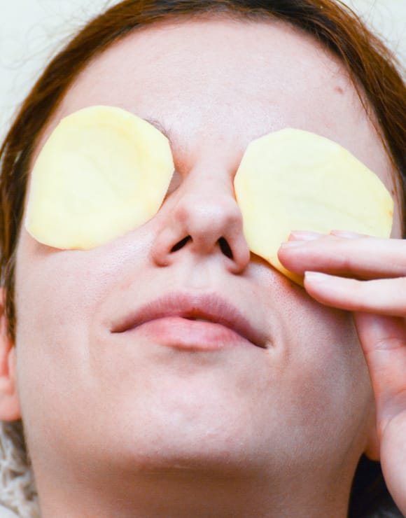 woman places potato slice son her eyes to eliminate baggy eyes